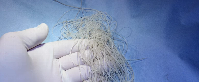 Srčani crv - simptomi, lečenje i iskustva